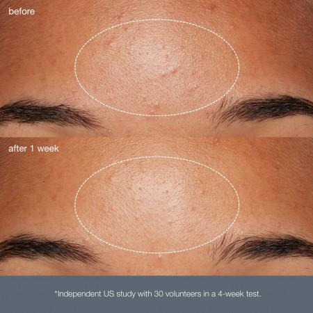 Dermalogica Daily Microfoliant - Щоденний мікрофоліант, 74г