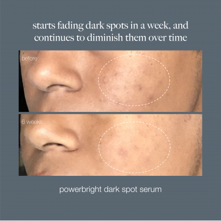 Dermalogica PowerBright Dark Spot Serum - Активная сыворотка для осветления и борьбы с пигментированной кожей, 30 мл