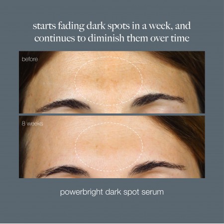 Dermalogica PowerBright Dark Spot Serum - Активная сыворотка для осветления и борьбы с пигментированной кожей, 30 мл