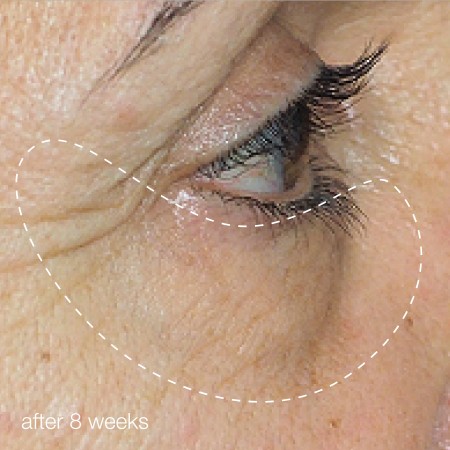 Dermalogica Awaken Peptide Eye Gel - Пробуджуючий пептидний гель для очей, 15 мл