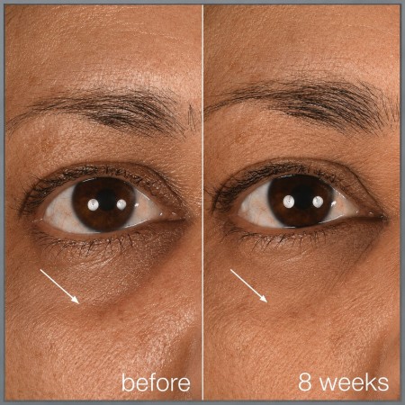Dermalogica Smart Eye Density Serum - Сироватка-альтернатива філерам для зони навколо очей, 15 мл